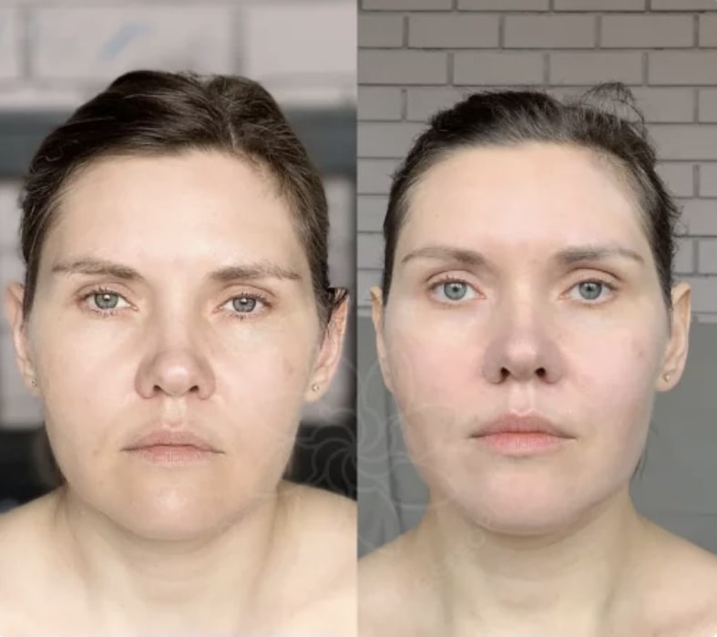 Results after training :: FACEPLASTIC AND OSTEOPATHY - FZCO